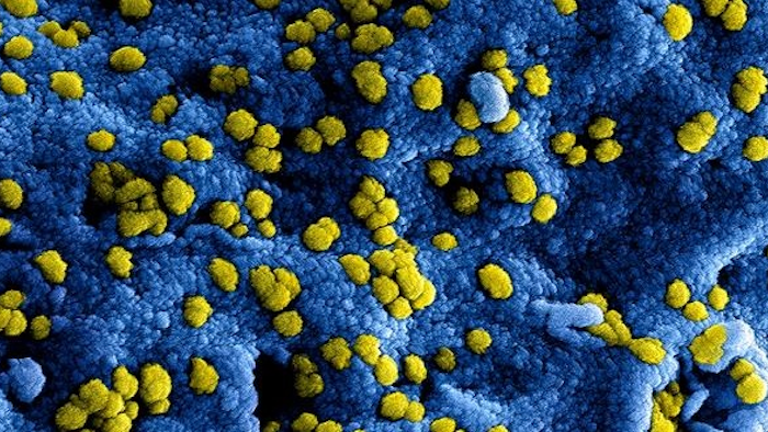 Coronavirus