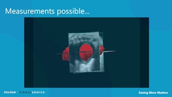 Maxresdefault 5f1af9f519021