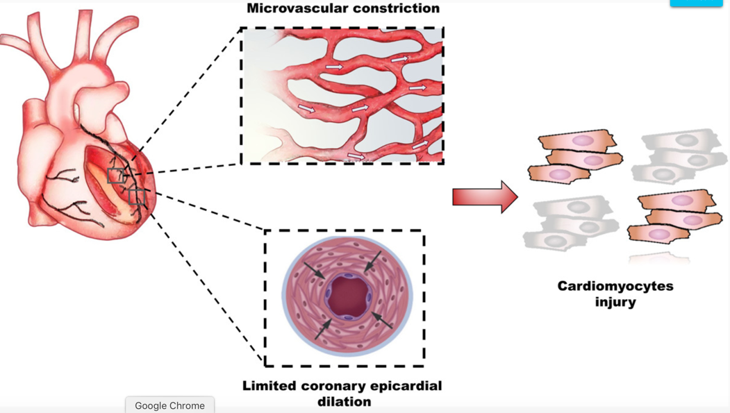 Coronary Vascular Function and Cardiomyocyte Injury A Report From the