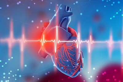 Illustration of heart with EKG reading in front of it