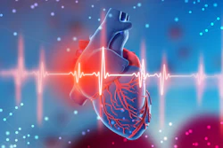 Illustration of heart with EKG reading in front of it