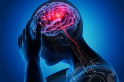 stroke image