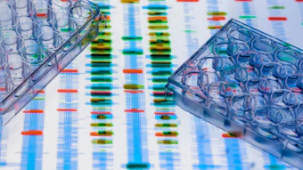 DNA sequencing gel with colored bands displayed beneath laboratory sample trays used in genetic analysis